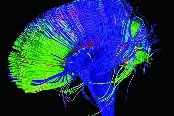 Neural pathways in the brain