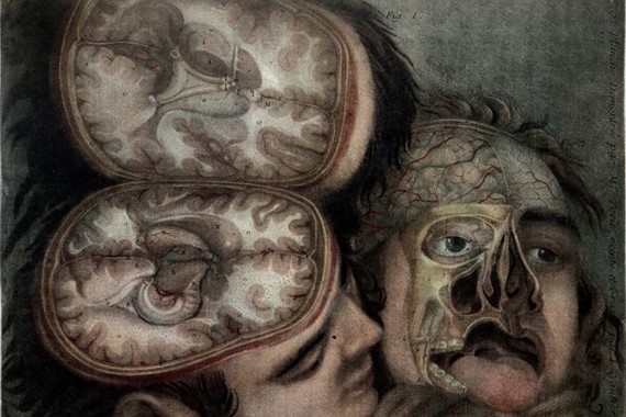WELL L0013383 Two dissected heads by Gautier d'Agoty credit Wellcome.jpg